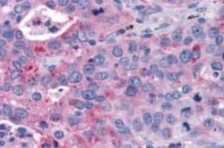 P2Y14/GPR105 Antibody, Novus Biologicals 50 &mu;g; Unconjugated:Antibodies,
